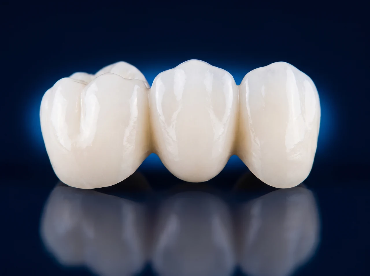 Clinical render of a three unit ceramic dental bridge on a deep blue surface